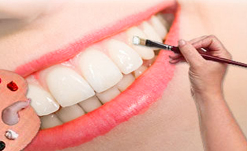 Achieve Dental Cosmetic Dentistry service